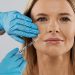 Inyección de relleno facial a una mujer